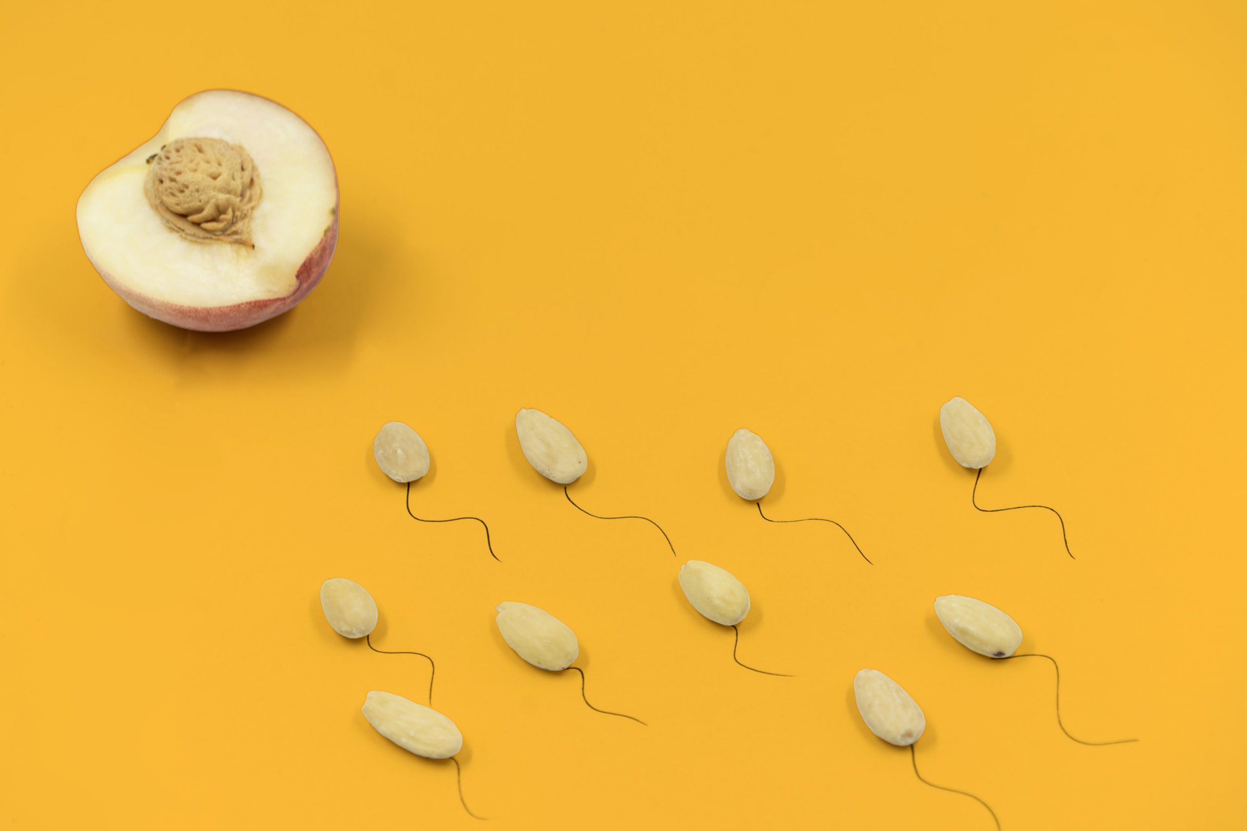 how long after a vasectomy can you have unprotected sex